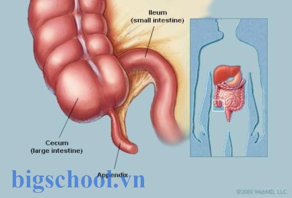 Appendix là gì? Nghĩa, cách dùng và ví dụ chi tiết, dễ hiểu 2 Viêm ruột thừa cấp: Cẩm nang những điều cần biết về bệnh | Vinmec
